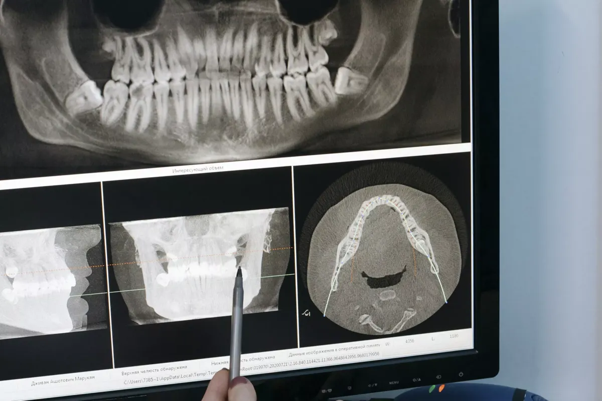 Pantalla con imágenes de radiografías de una boca